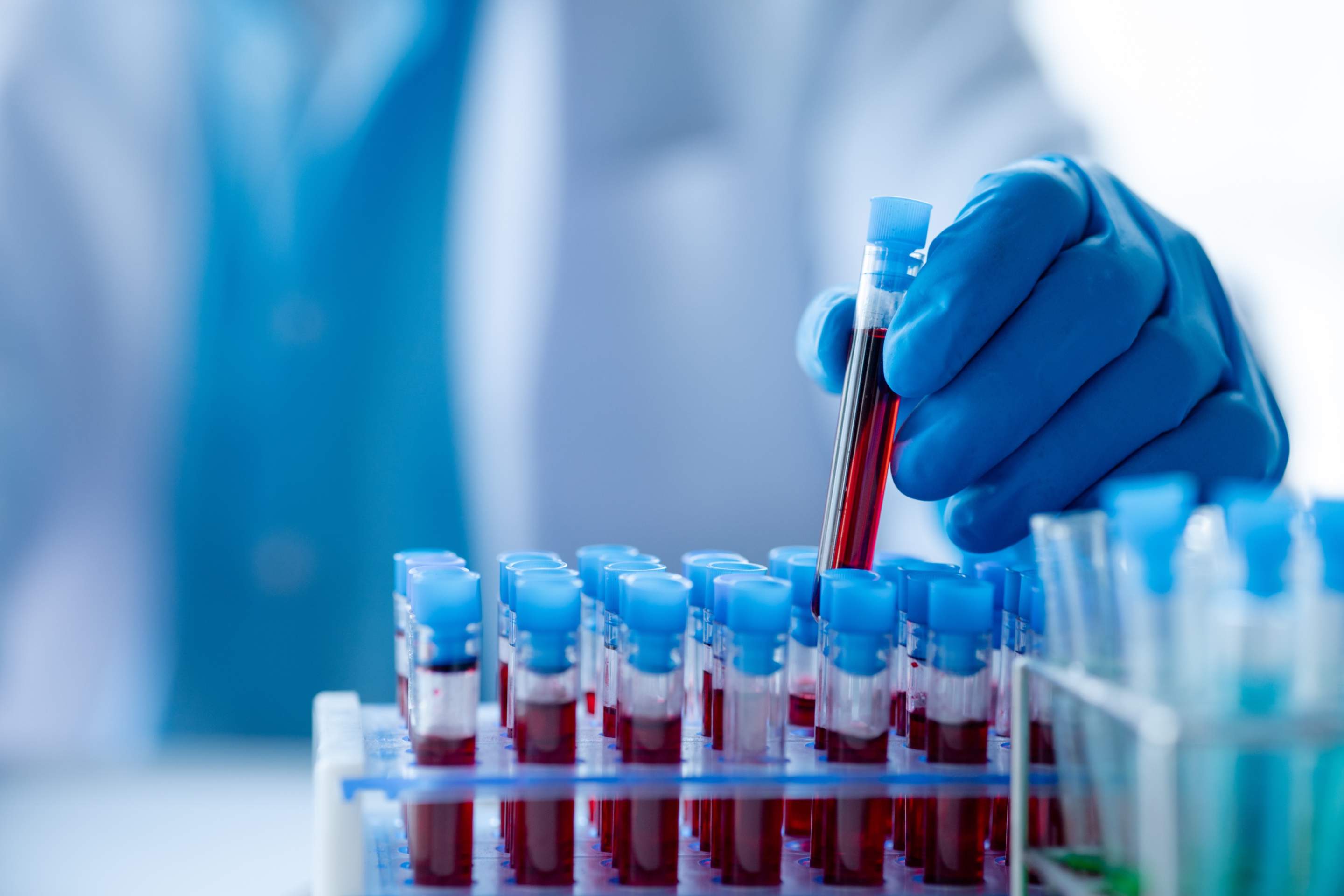 Die 8 besten Bluttest Zentren in Zürich 2025: Präzise Diagnosen und Gesundheitschecks